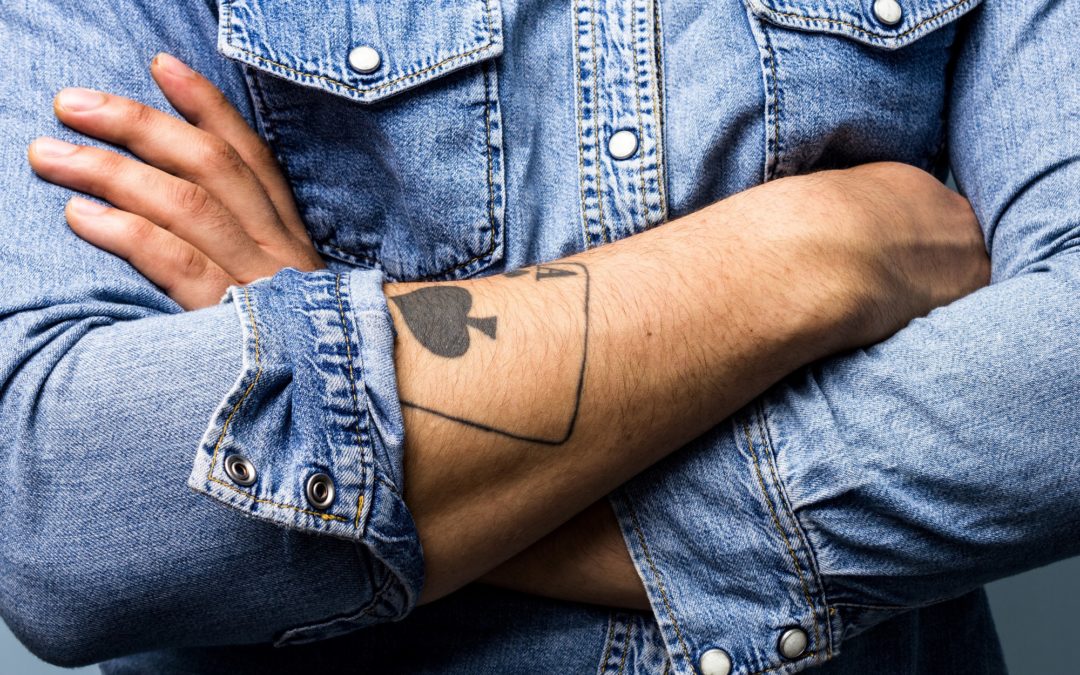 Regret Your Ink? How to Get Rid of an Unwanted Tattoo